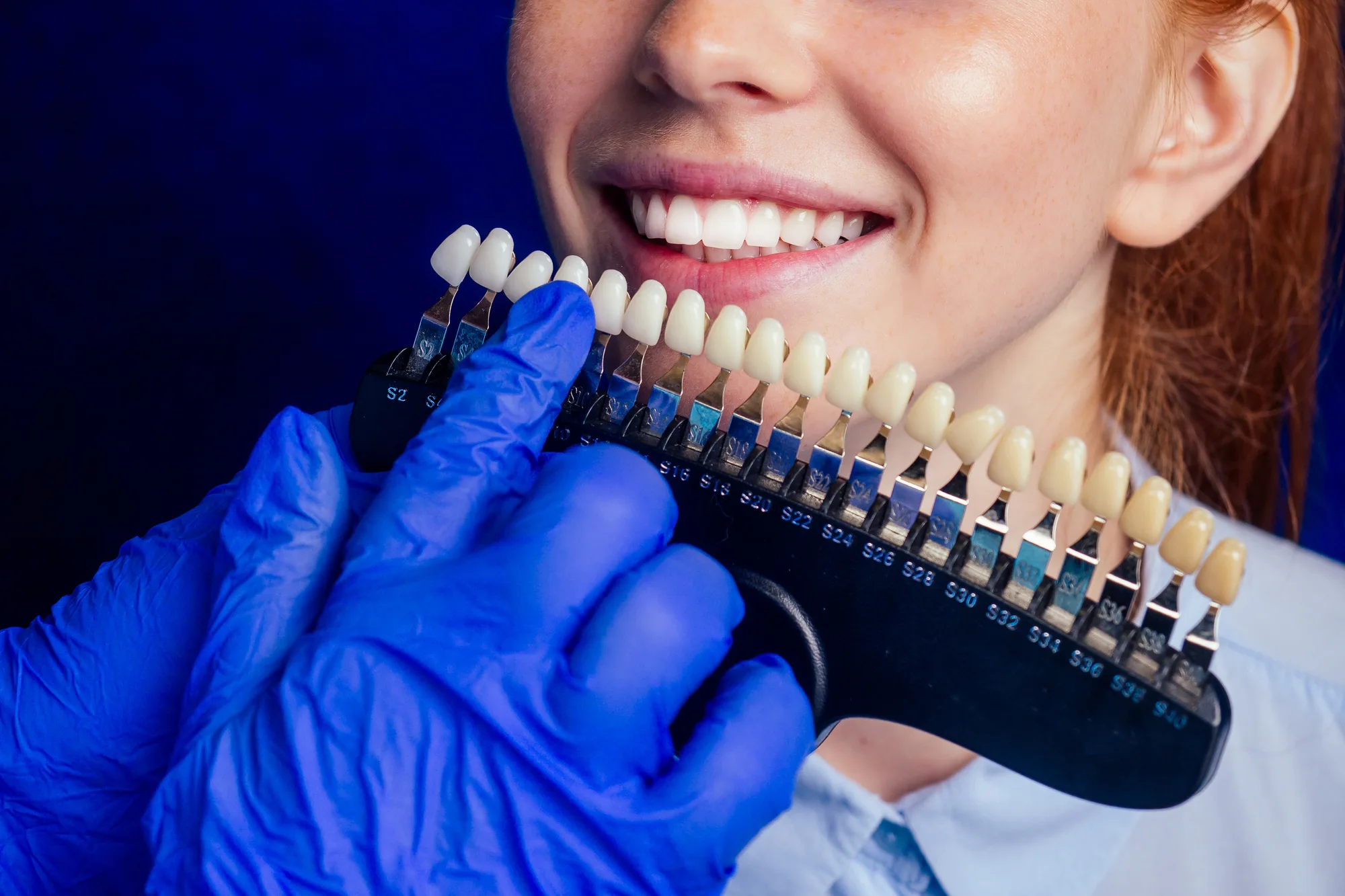 A dentist holding a shade guide against a smiling patient’s teeth